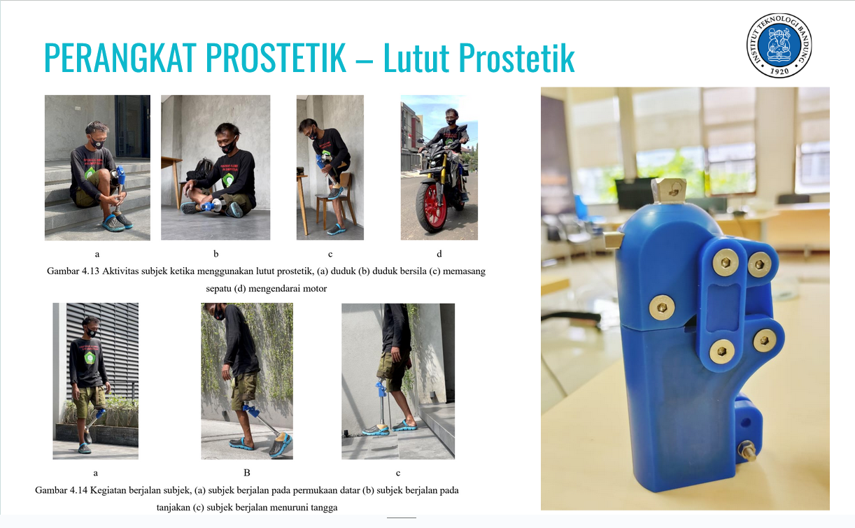 Lutut Prostetik - Image 4